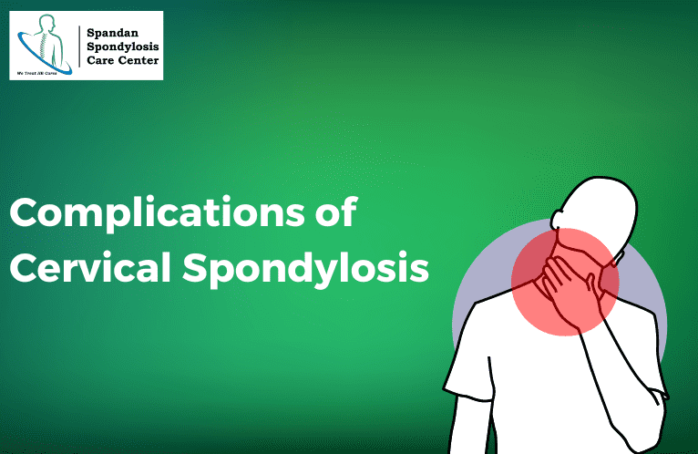 complications-of-cervical-spondylosis
